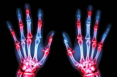 Δείτε τι συμβαίνει στα δάχτυλά σας κάθε φορά που κάνετε "κρακ" (vid)