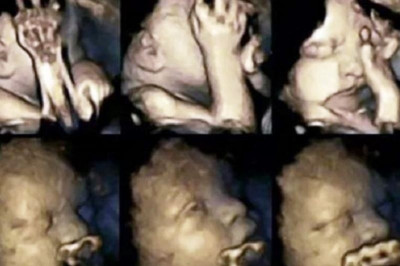 Συγκλονιστικό: Δείτε πώς αντιδρά το έμβρυο στο τσιγάρο κατά τη διάρκεια της εγκυμοσύνης (βίντεο)