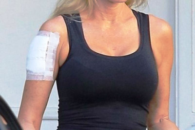 Η σταρ σβήνει το tattoo με το όνομα του πρώην της!