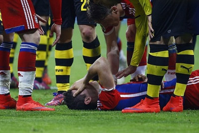 Μπάγερν: Κάταγμα στην άνω γνάθο και τη μύτη ο Λεβαντόφσκι