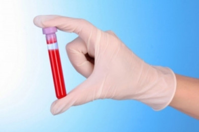 Αυξημένα λευκά αιμοσφαίρια: Δείτε τι σημαίνει ο δείκτης
