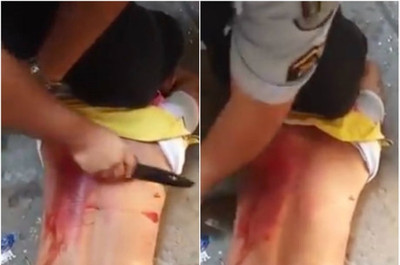 ΣΟΚΑΡΙΣΤΙΚΟ: Φρικτά βασανιστήρια με μαχαίρι σε ανήλικο!