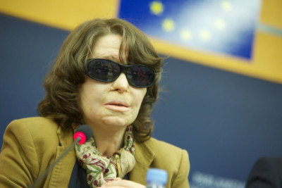 Στην Ελλάδα οι… Κούνεβες θα καίγονται πάντα με βιτριόλι!