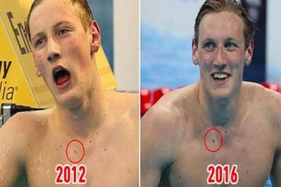 Απίστευτο! Ολυμπιονίκης του Ρίο σώθηκε από καρκίνο λόγω… θεατή! (photos)