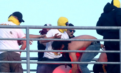 ΠΑΟΚ-ΑΕΚ: Φωτογραφίες που σοκάρουν – Έβαλαν φωτιά στα οπίσθια οπαδού!