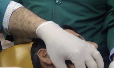 Ακόμα και οι γιατροί σοκαρίστηκαν μόλις είδαν αυτό που βγήκε από το σαγόνι αυτού του άνδρα (video)