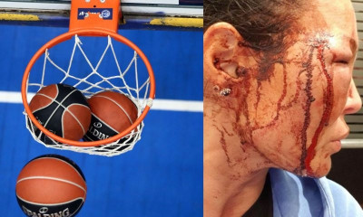 Καταγγελία-σοκ από τη σύντροφο πρώην μπασκετμπολίστα – Σκληρές εικόνες (photos)