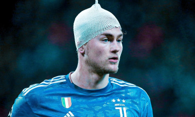 Champions League: Σοκάρει το ματωμένο κεφάλι του Ντε Λιχτ (video+photos)