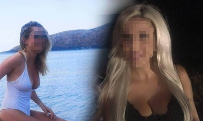 Επίθεση με βιτριόλι: Ανά 10 ημέρες θα χειρουργείται η Ιωάννα - Τι λένε οι γιατροί