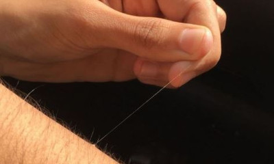 Γιατί κάποιες τρίχες στο σώμα σου μεγαλώνουν απίστευτα γρήγορα;