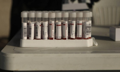 Κρούσματα σήμερα: «Επέλαση» μεταλλάξεων - Σε ποιες περιοχές εντοπίστηκαν 546 νέα στελέχη