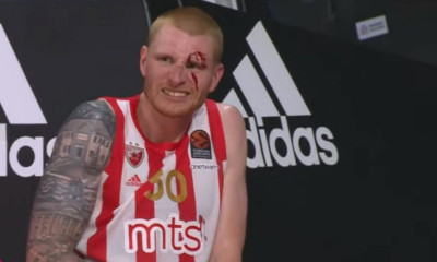 Έξι εβδομάδες εκτός ο Ουάιτ, δυσαρέσκεια Ερυθρού Αστέρα για Παναθηναϊκό (video)