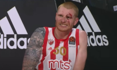 Ερυθρός Αστέρας: Πετυχημένη επέμβαση για Ουάιτ (photos)