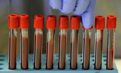 Κατάργηση του clawback στις εξετάσεις ζητούν 9 στους 10 γιατρούς - Έρευνα της Alcο