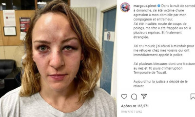 Άλλη διάσταση παίρνει το θέμα της κακοποίησης της Μαργκό Πινό, από τον Αλέν Σμιτ