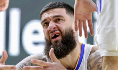 Πουαριέ μετά το σπασμένο δόντι από τον ΜακΚίσικ: «Είμαι ακόμη όμορφος» (photo)