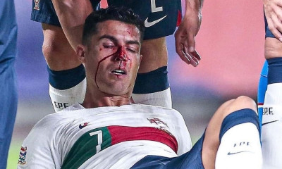 Nations League: Ο Βατσλίκ τραυμάτισε τον Κριστιάνο Ρονάλντο (Video+photos)