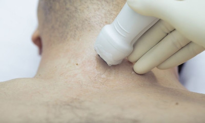 Αθηροσκλήρωση καρωτίδων: Οι επιπτώσεις στην ακοή