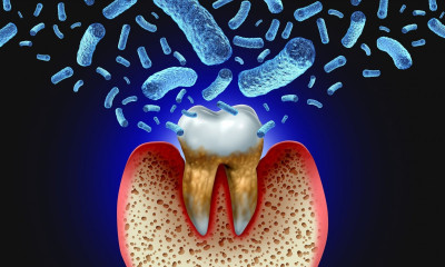 Παχυσαρκία και καρκίνος του στόματος: Πώς συνδέονται