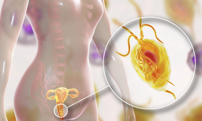 Το κοινό ΣΜΝ που πολλαπλασιάζει τον κίνδυνο καρκίνου του τραχήλου