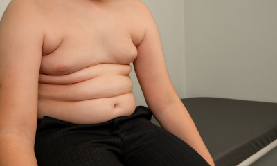 Μπορεί ένα παιδί να υποβληθεί σε επέμβαση απώλειας βάρους;