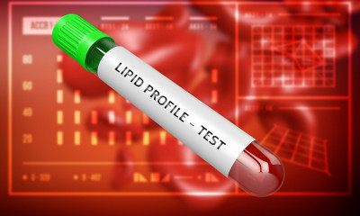 Χοληστερίνη και τριγλυκερίδια: Πότε αυξάνουν τον κίνδυνο άνοιας