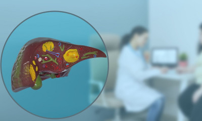 Μη αλκοολική στεατοηπατίτιδα: Η διατροφή για το λίπος στο συκώτι