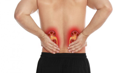 Πέτρες στα νεφρά: Πόσο αυξάνουν τον κίνδυνο οι τροφές με ζάχαρη