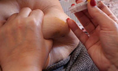 Σεμαγλουτίδη: Πόσο μειώνει τον κίνδυνο καρδιαγγειακών στους υπέρβαρους