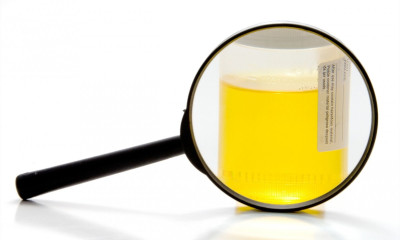 Μπορεί η εξέταση ούρων να εντοπίσει τον κίνδυνο καρδιακής ανεπάρκειας;