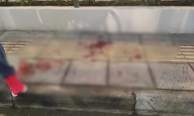 Αγρίνιο: Άγρια συμπλοκή με δύο τραυματίες - Εξετάζονται οπαδικά κίνητρα