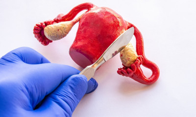 Προληπτική αφαίρεση ωοθηκών: Με ποια προβλήματα συνδέεται