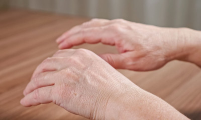 Το παράδοξο σημάδι καρκίνου που εμφανίζεται στα χέρια και στα πόδια