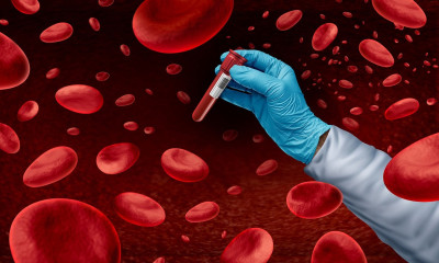 Καρκίνος αίματος: Η επέμβαση που μειώνει τον κίνδυνο για τις γυναίκες