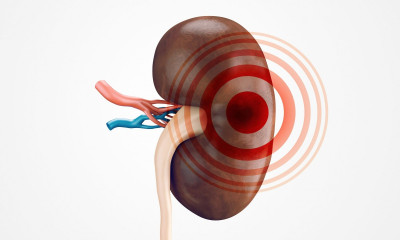 Ποιο είναι το σύνδρομο που επηρεάζει καρδιά, νεφρά και ήπαρ