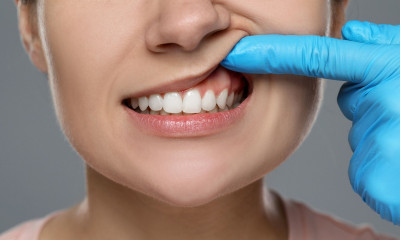 Περιοδοντίτιδα: Με ποιες παθήσεις συνδέεται