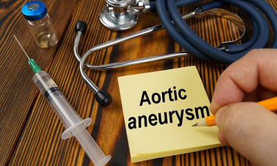 Ανεύρυσμα κοιλιακής αορτής: Τα φάρμακα που συμβάλλουν στην πρόληψη