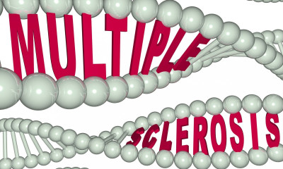 Λοιμώδης μονοπυρήνωση & σκλήρυνση κατά πλάκας: Πώς συνδέονται