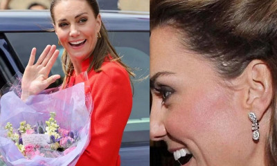 Κέιτ Μίντλετον: Η ουλή 6 εκατοστών στο κεφάλι & το κρίσιμο χειρουργείο