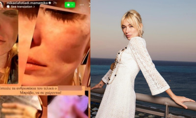 Θύμα ξυλοδαρμού το γνωστό μοντέλο Μικαέλα Φωτιάδη