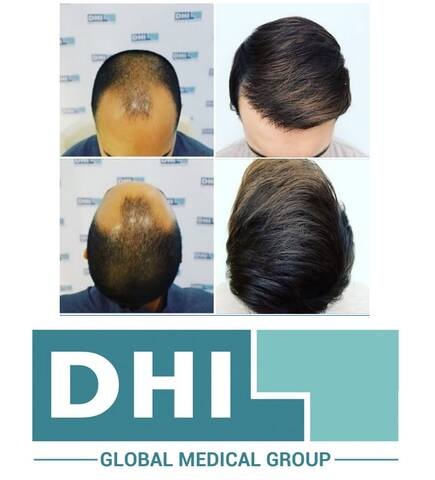 dhi4