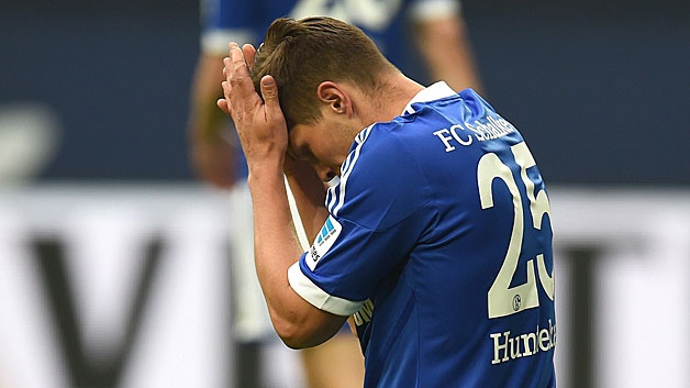 s04 bmg knees huntelaar 628
