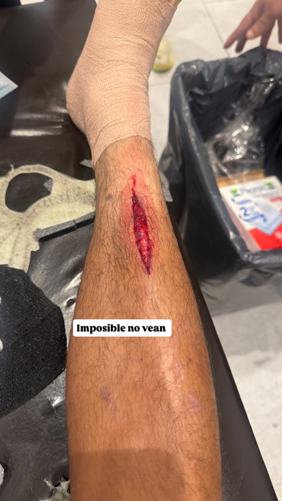 orbelin-pineda-injury