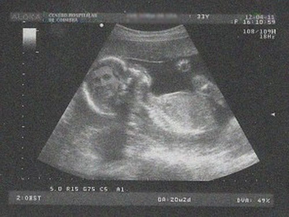 Ο Σάβατζ σε… υπερηχογράφημα!