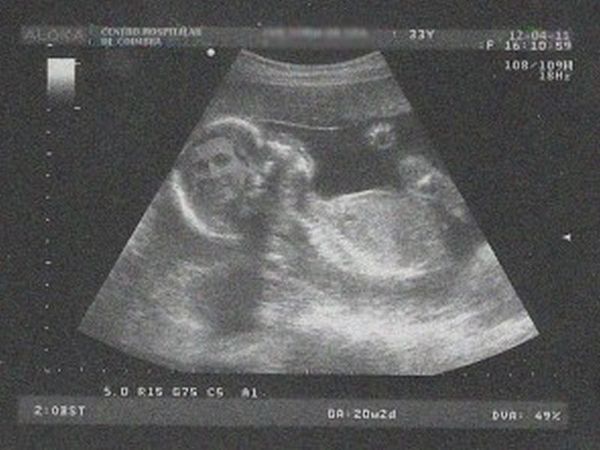 Ο Σάβατζ σε… υπερηχογράφημα!