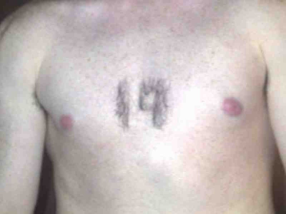 Το #19 του Ρούνεϊ