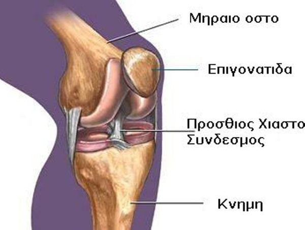 Αστάθεια της Επιγονατίδας