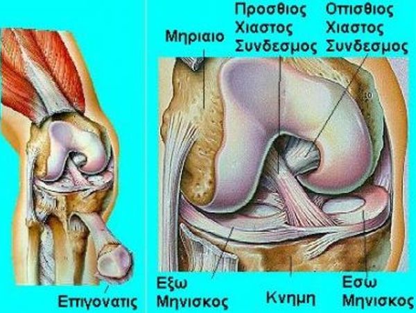 Ρήξη οπίσθιου Χιαστού