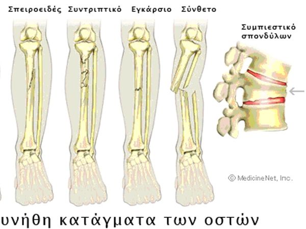 Οσφυική μοίρα αθλητών