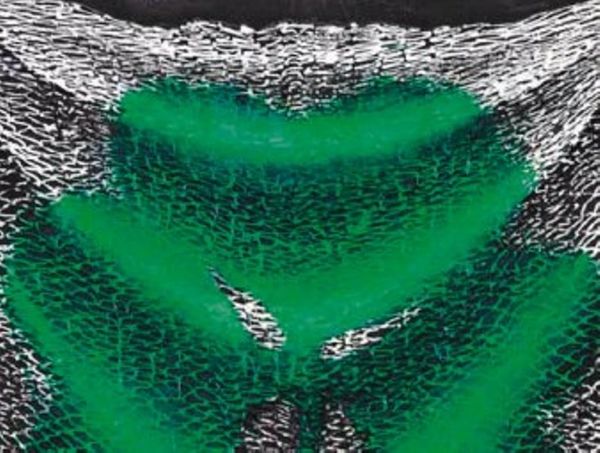 Τον «τσαλακώνουν» τα διαρκείας 